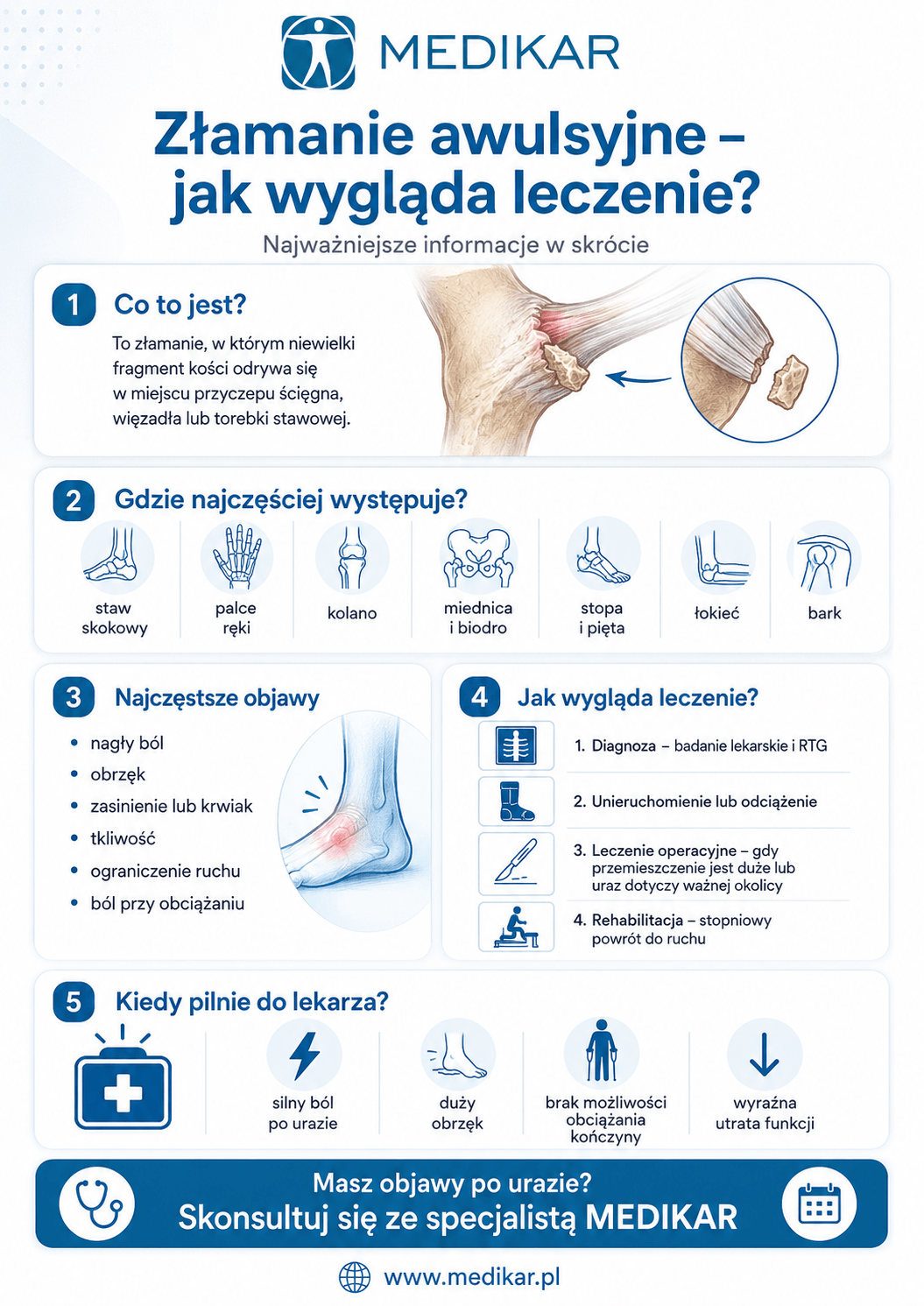 złamanie awulsyjne infografika